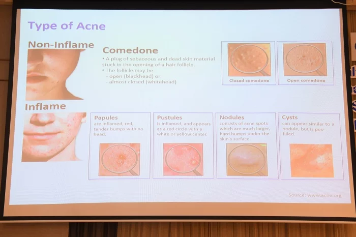 re10. พญ. สุเพ็ญญา วโรทัย บรรยาย ในหัวข้อ “สมดุลแบคทีเรียบนผิว (Skin Microbiome)